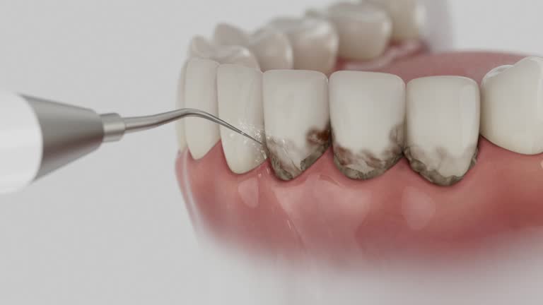 Reliable Teeth Cleaning And Checkup contractor in Lauderdale County County, MS by Dentist Open Now